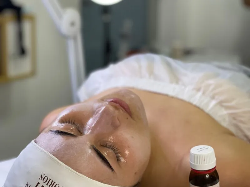 Professional chemical peel skin treatment at Regener8 Aesthetics, Birmingham